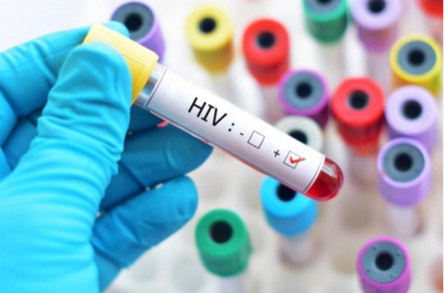 Trường hợp nào xác định người phơi nhiễm, nhiễm HIV do tai nạn rủi ro nghề nghiệp? - Ảnh 1.